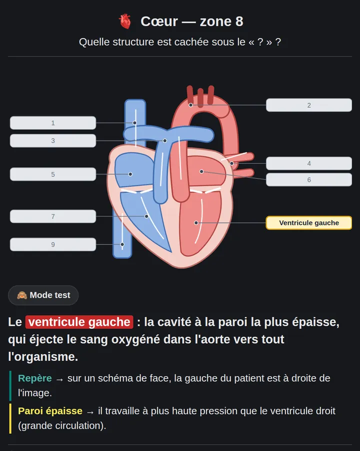 Carte de médecine : schéma du cœur avec occlusion d'image sur le ventricule gauche